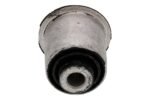 Control Arm Bushing Kit - Mercedes-Benz - Image 5